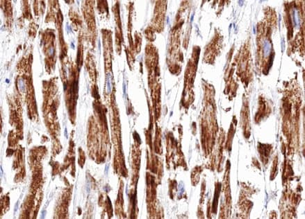 DOK7 Antibody