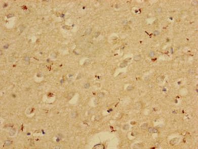 Polyclonal Rabbit anti-Human SERPINE1 / PAI-1 Antibody (WB)