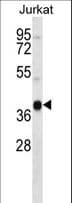 RNF174 / MARCH4 Antibody (aa302-331)