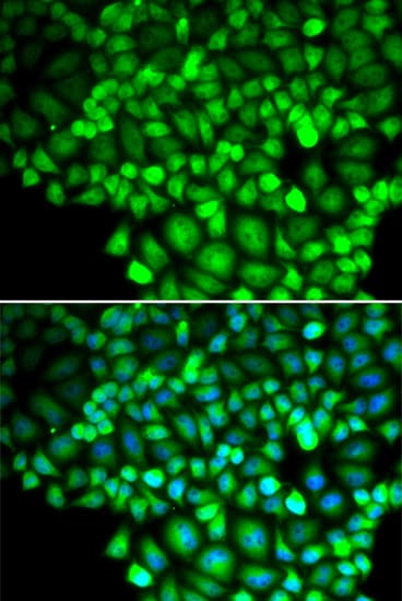 ALOX15B / 15-LOX-2 Antibody