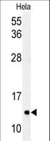 IHC-plus™ MAP1LC3C / LC3C Antibody (Thr48)