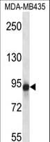 Polyclonal Rabbit anti-Human GRM6 / MGLUR6 Antibody (aa369-398, WB)