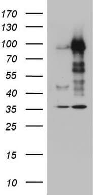 MDM2 Antibody (aa119-438, clone OTI22G3)