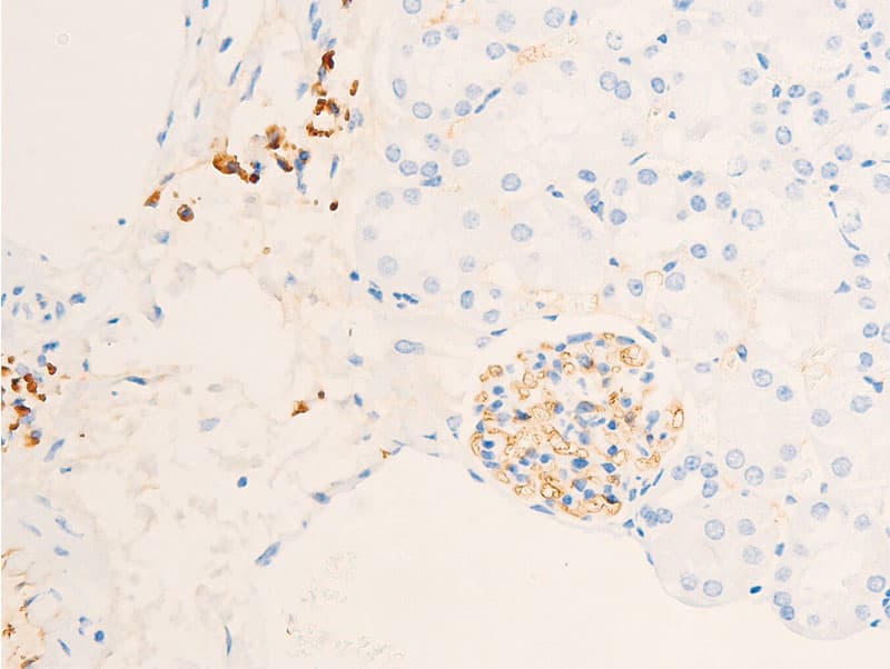 NR3C1/Glucocorticoid Receptor Antibody (phospho-Ser211)