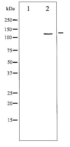 Polyclonal Rabbit anti-Human ITGB3 / Integrin Beta 3 / CD61 Antibody (phospho-Tyr773, IHC, WB)