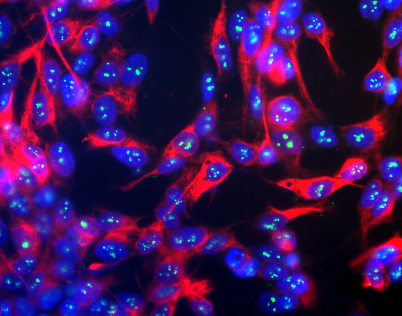 FBL / FIB / Fibrillarin Antibody (clone 38F3)