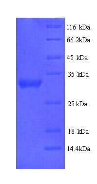 Human DLK2 Protein (Recombinant His)