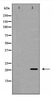 EPO / Erythropoietin Antibody