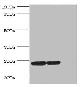 Thymidylate Kinase Antibody
