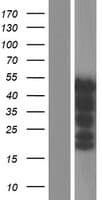 PAX8 Protein (Over-Expression Lysate Myc-DDK (Flag))