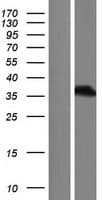 PAX8 Protein (Over-Expression Lysate Myc-DDK (Flag))