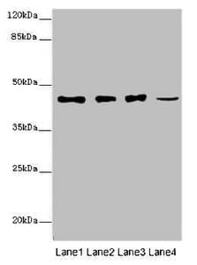 SIRPB1 / CD172b Antibody