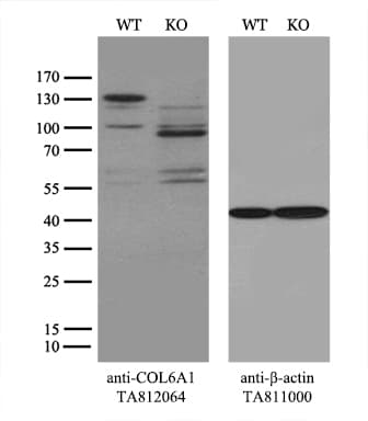 COL6A1 / Collagen VI Alpha 1 Antibody (aa752-835, clone OTI1G8)