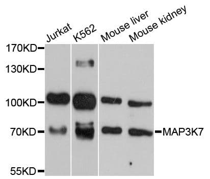 MAP3K7 / TAK1 Antibody