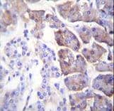 CPB / Carboxypeptidase B Antibody (aa9-37)