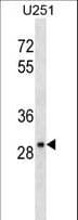FAIM2 / LIFEGUARD Antibody (aa76-105)