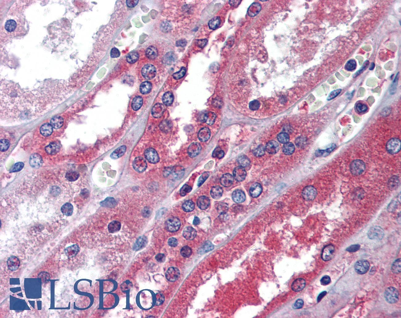 Polyclonal Rabbit anti-Human ALB / Serum Albumin Antibody (aa540-589, IHC, WB)