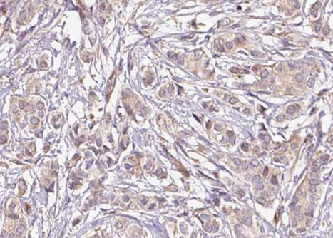 Polyclonal Rabbit anti-Human MED1 / TRAP220 Antibody (phospho-Thr1457, IHC, IF, WB)