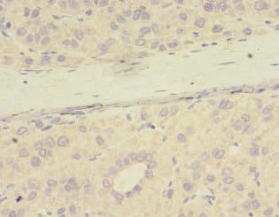 Polyclonal Rabbit anti-Human PME-1 / PPME1 Antibody (IHC, WB)