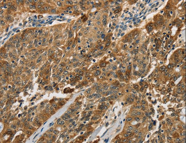 CTSE / Cathepsin E Antibody