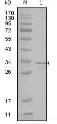 IHC-plus™ FRK Antibody (clone 1A8H2C12)