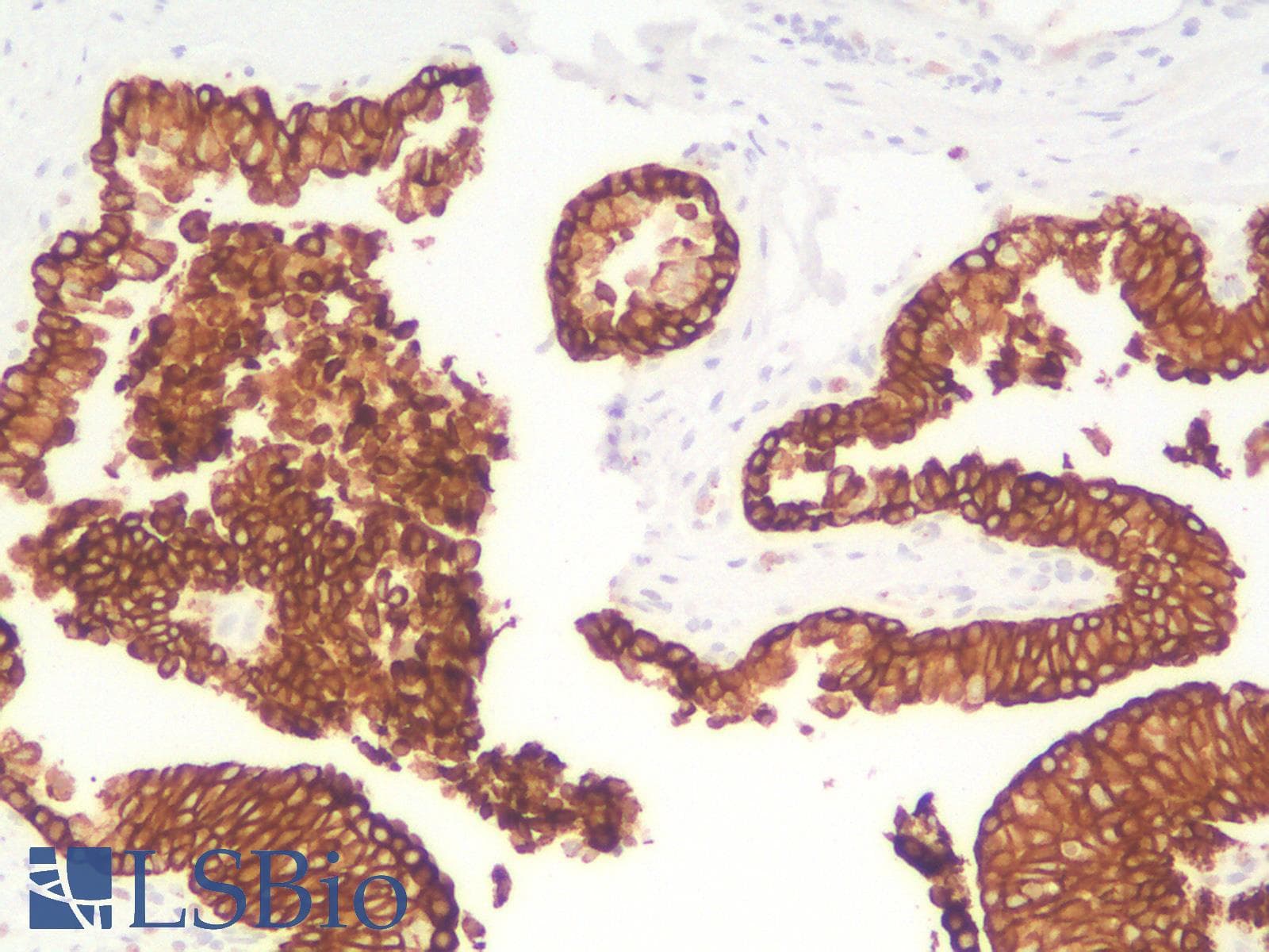 PathPlus™ KRT19 / CK19 / Cytokeratin 19 Antibody (Concentrated)