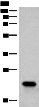 RAC3 Antibody