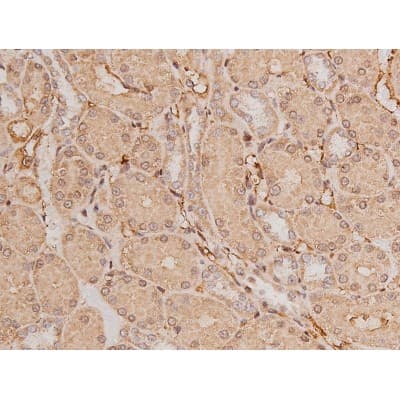 Polyclonal Rabbit anti-Human c-Kit / CD117 Antibody (IHC, IF, WB)