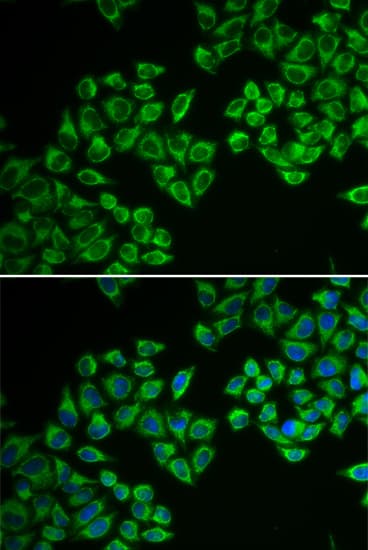 Polyclonal Rabbit anti-Human HMG-CoA Reductase / HMGCR Antibody (IHC, IF, WB)