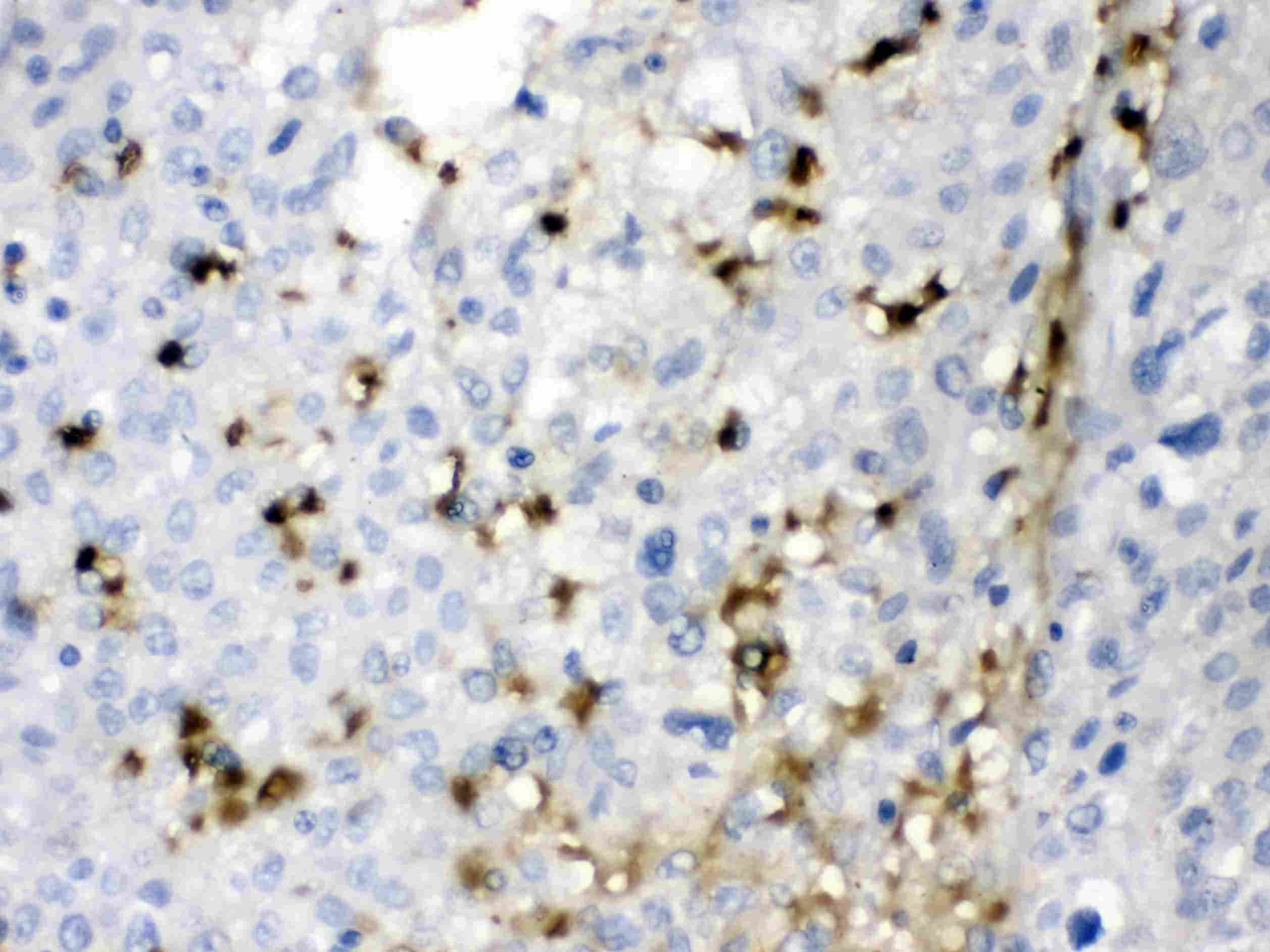 CA2 / Carbonic Anhydrase II Antibody