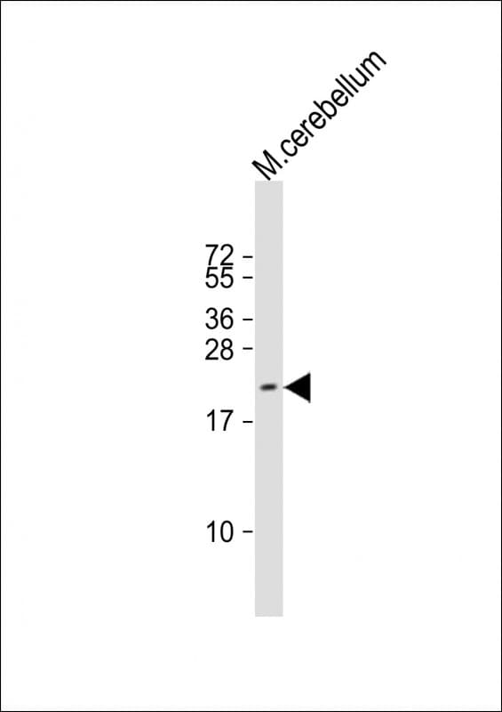 Polyclonal Rabbit anti-Human RAP2 Antibody (aa16-38, WB)