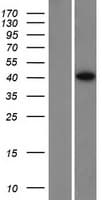SPO11 Protein (Over-Expression Lysate Myc-DDK (Flag))