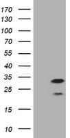 CD20 Antibody (clone OTI10A5)