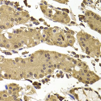 Polyclonal Rabbit anti-Human SETD5 Antibody (IHC, IF, WB)