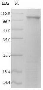 Mouse FAP Alpha Protein (Recombinant 6His-SUMO, N-terminus)
