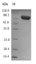 Human DYNC2LI1 / D2LIC Protein (Recombinant GST, N-terminus)