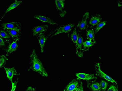 MAP1LC3B2 Antibody
