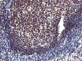 MEF2C Antibody (clone UMAB17)