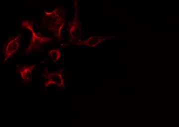 PRKAR1B Antibody