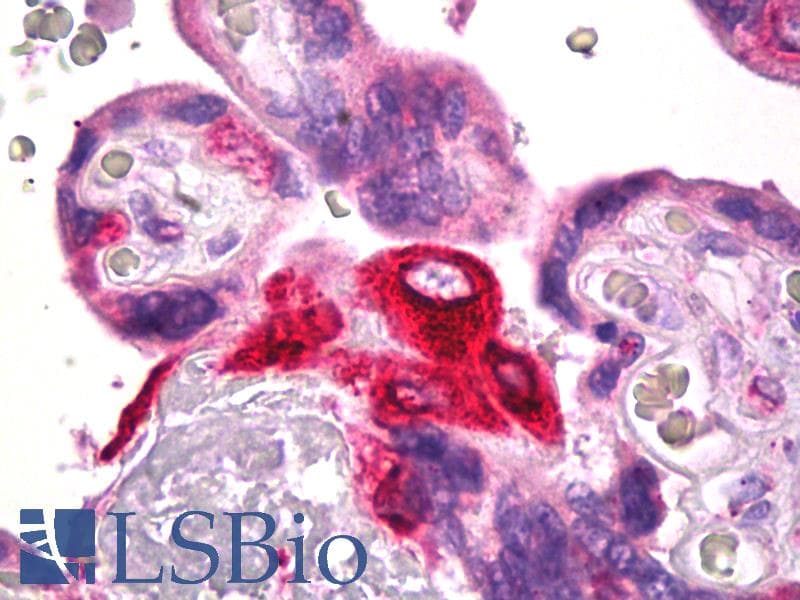 IHC-plus™ Polyclonal Rabbit anti-Human PGES / PTGES Antibody (IHC, WB)