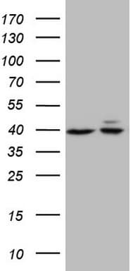 ACTB / Beta Actin Antibody (aa30-100)