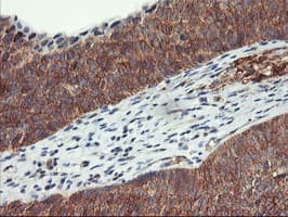 Monoclonal Mouse anti-Human VASP Antibody (clone OTI1F3, IHC, WB)