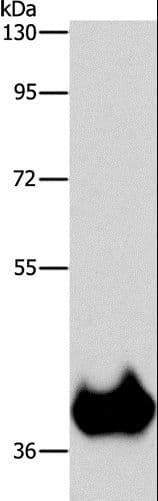 Polyclonal Rabbit anti-Human ASPA Antibody (IHC, WB)