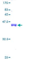 Human RPS20 / Ribosomal Protein S20 (Recombinant GST)