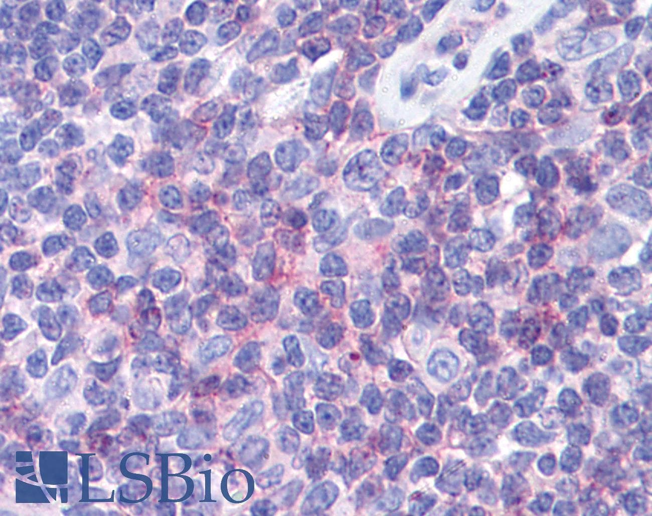 IHC-plus™ CD225 / IFITM1 Antibody