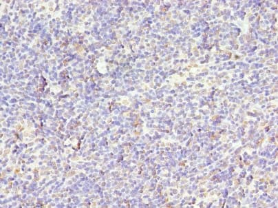 STK38L / NDR2 Antibody