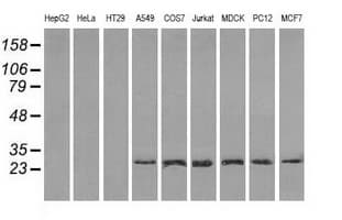 RPA2 / RFA2 / RPA34 Antibody (clone OTI1H10)