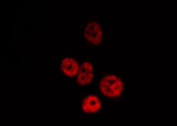 RELA / NFKB p65 Antibody