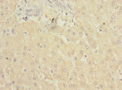 IHC-plus™ Polyclonal Rabbit anti-Human Complement C5 Antibody (IHC)