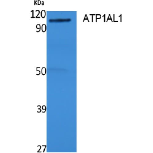 ATP12A Antibody (380-460 aa, Internal)